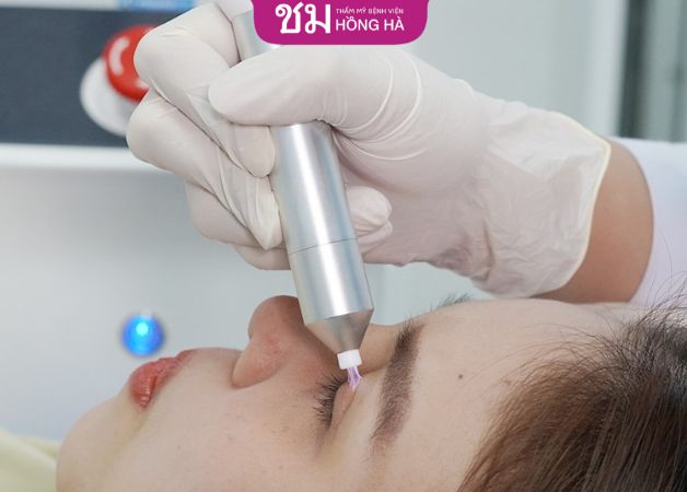 Giảm sưng cấp tốc bằng tia plasma lạnh