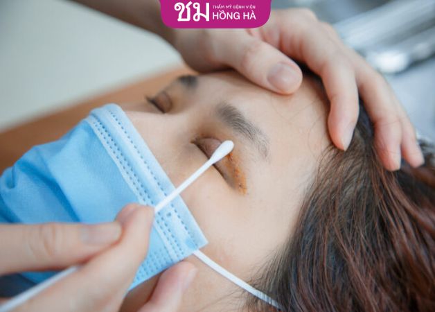 Vệ sinh mắt sau cắt mí