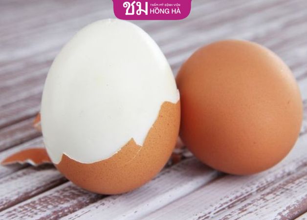Sử dụng trứng gà luộc làm tan máu bầm sau cắt mí