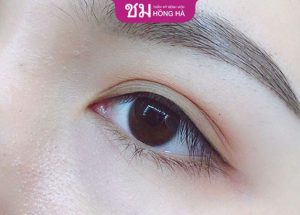 Cắt mí bao lâu thì phun mí được – Yếu tố ảnh hưởng thời gian