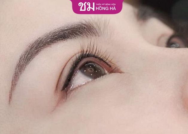 Cắt mí bao lâu thì phun mí được - Sau cắt mí 3 tháng có thể phun mí