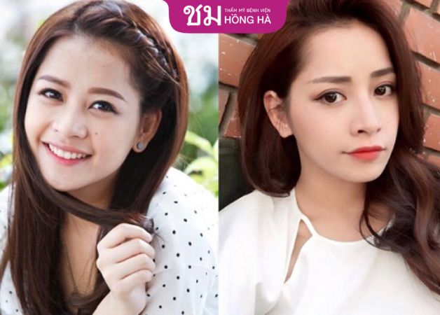 Chi Pu sau cắt mí nổi tiếng với danh sưng ca sĩ