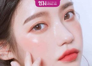 Cắt mí mắt có phá tướng không – Sao Việt đổi vận nhờ cắt mí