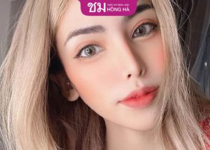 Cắt mí có phải cắt chỉ không – Hướng dẫn chăm sóc mắt sau cắt chỉ