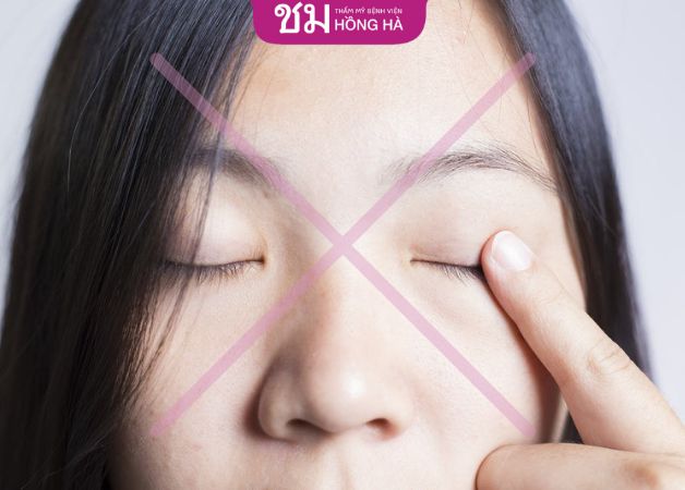 Không tác động lên mí mắt sau khi cắt mí