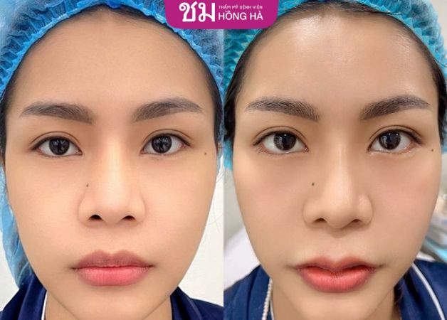 Đôi môi tim với những đường nét quyến rũ
