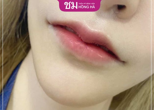 Môi trái tim đẹp tự nhiên