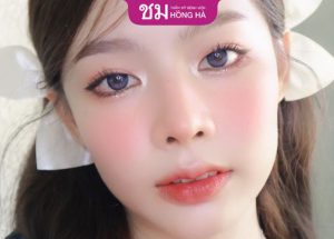 Cắt môi trái tim sau bao lâu thì đẹp – 3 Yếu tố ảnh hưởng