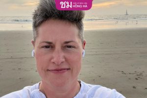 Độn trán nam hóa là gì? Có nguy hiểm không? Chi phí bao nhiêu?