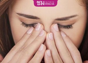 Hướng dẫn chăm sóc sau cắt mí nhanh hồi phục, an toàn