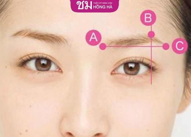 Nâng cung chân mày sau 3 - 6 tháng lành sẹo