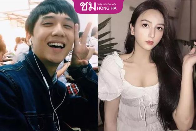 Nâng ngực cho người chuyển giới giúp họ có cơ thể mơ ước