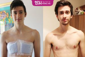 Phẫu thuật chuyển giới chấp nhận rủi ro, sống là chính mình