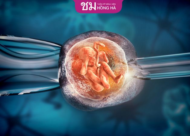 Thụ tinh ống nghiệm IVF