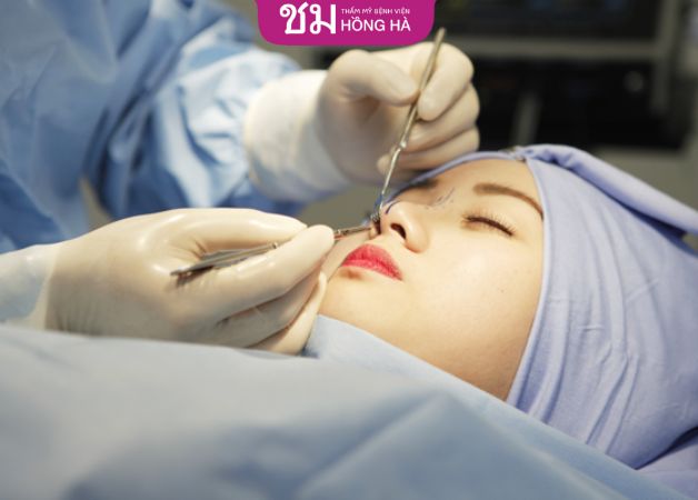 Nên chỉnh sửa mũi hỏng càng sớm càng tốt