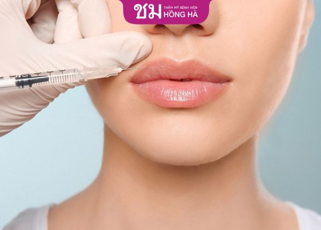 Tiêm môi trái tim có hại không - Không có hại nếu filler đảm bảo chất lượng