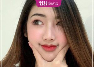 Tiêm môi trái tim được bao lâu – Ưu điểm khi tiêm môi trái tim