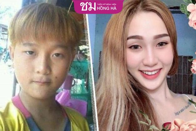 Những thông tin cơ bản về transgirl