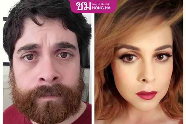 Dấu hiệu nhận biết về người chuyển giới nữ - transwoman