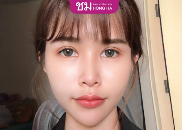 Khách hàng sở hữu diện mạo trẻ trung, đôi mắt thu hút