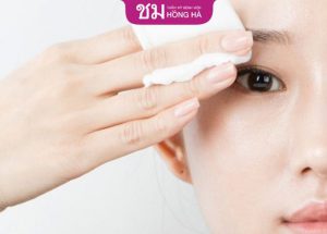 Chăm sóc mắt sau cắt mí 1 tháng- Mắt hồi phục, sắc nét