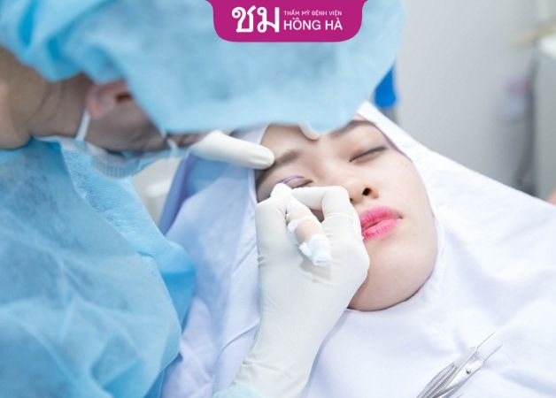 Tay nghề chuyên môn của bác sĩ yếu kém là nguyên nhân hàng đầu khiến mí mắt nhiễm trùng