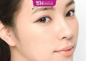 Kỹ thuật nâng cung chân mày giúp trẻ hóa mắt toàn diện