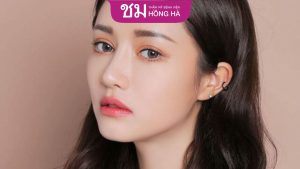 Điểm khác biệt giữa nâng mũi bán cấu trúc S Line, L Line