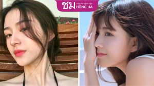 Top địa chỉ nâng mũi uy tín tại Hà Nội an toàn và chất lượng