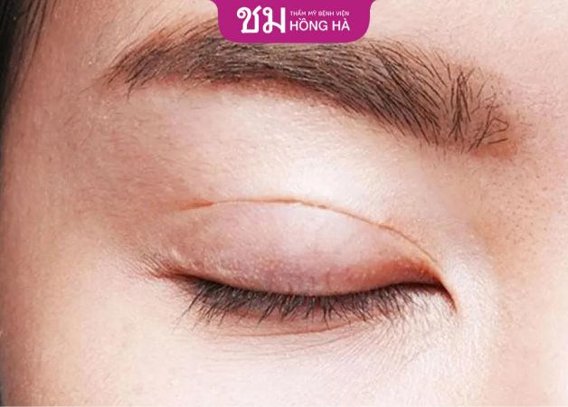 Nếu chỉ không thể tự tiêu bạn nên đến gặp bác sĩ