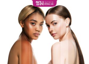 Da đen bẩm sinh có trắng được không – Kinh nghiệm trắng da