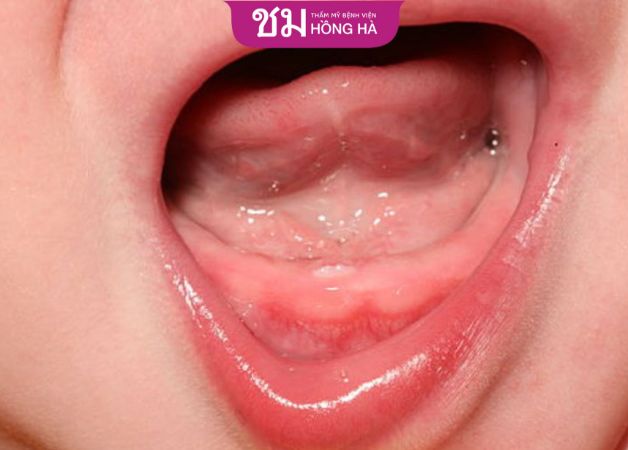 Dấu hiệu nhận biết trẻ mọc răng