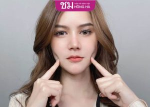 Cắt mí Thái Lan- Sở hữu đôi mắt 2 mí to tròn vĩnh viễn chuẩn Thái