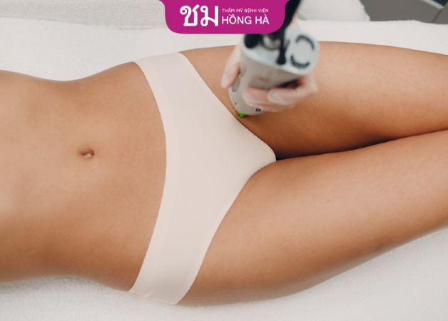 Bạn có thể tẩy lông vùng kín bằng công nghệ hiện đại, triệt lông vĩnh viễn