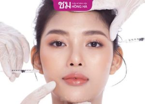 Filler giá bao nhiêu – Mức giá tiêm filler ở từng vị trí trên mặt