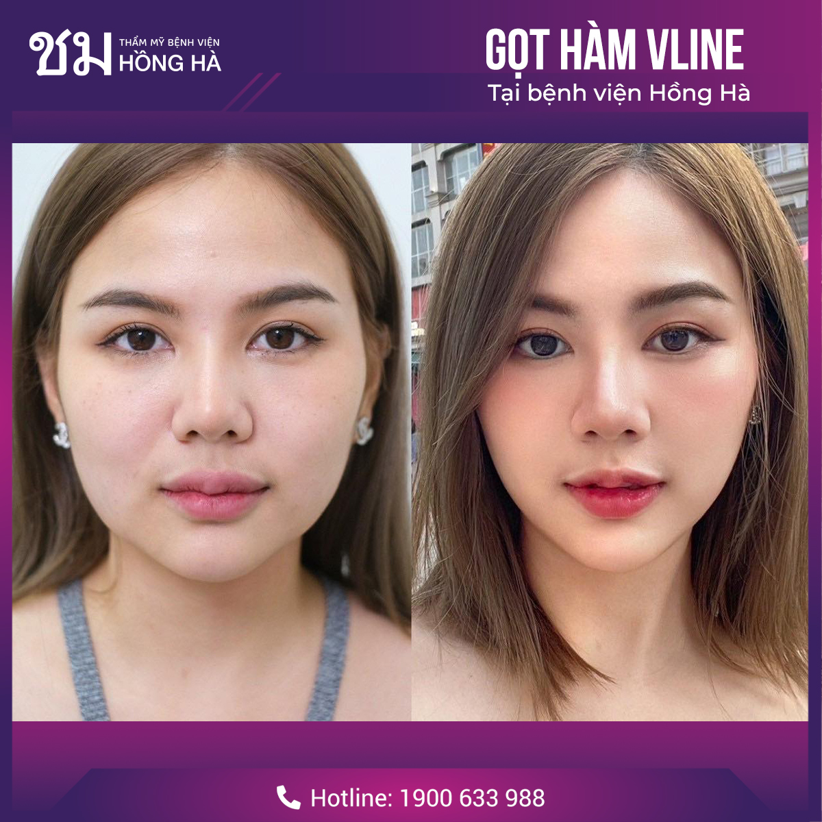 Chi phí cạnh tranh