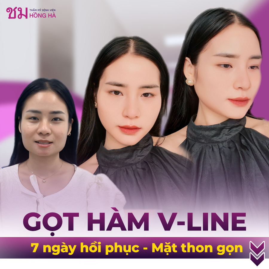 Hồi phục nhanh chóng chỉ sau 7 ngày