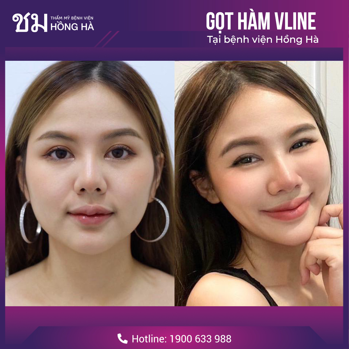 Khách hàng lột xác diện mạo