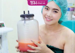 Hút mỡ Thái Lan – Đánh bay mỡ thừa, sở hữu vòng 2 thon gọn