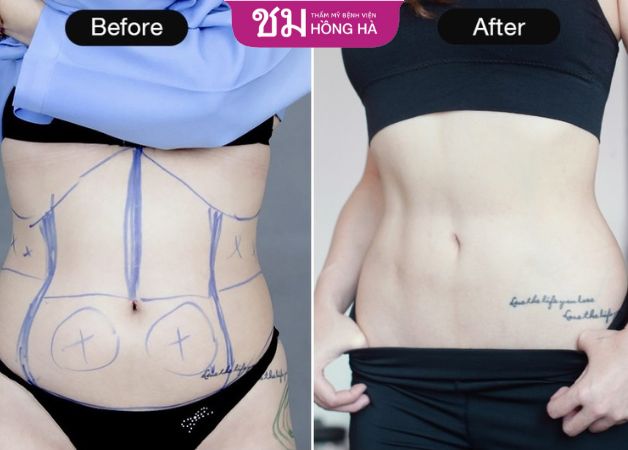 Thời gian thấy được kết quả ở mỗi người là khác nhau