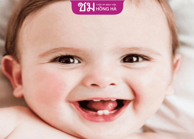 Trẻ mọc răng sớm có thể do nguyên nhân dư thừa canxi