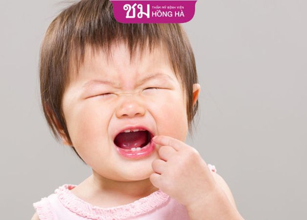 Khi mọc răng trẻ thường có biểu hiện khóc lóc, rên rỉ