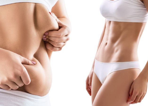 Hút mỡ giảm béo cấp tốc