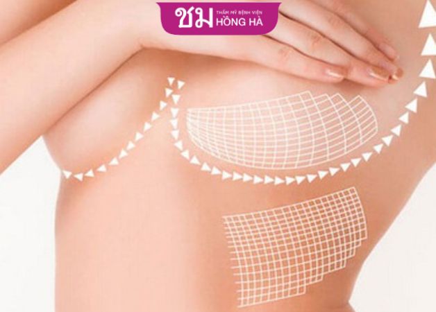 Cần cung cấp đủ chất dinh dưỡng sau khi cắt ngực