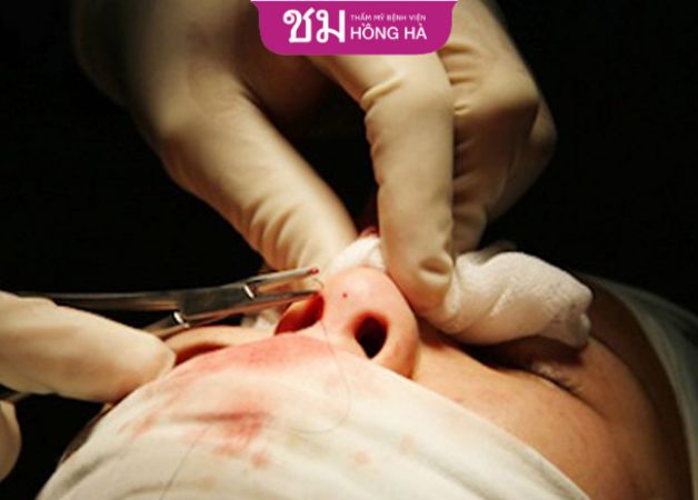 Địa chỉ thực hiện thẩm mỹ là một trong những yếu tố ảnh hưởng lớn tới giá dịch vụ