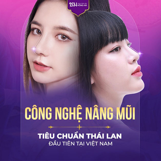 Nâng mũi an toàn cho kết quả đẹp như ý muốn, không gây biến chứng
