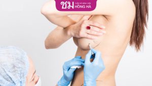 Các phương pháp cắt ngực chuyển giới phổ biến hiện nay