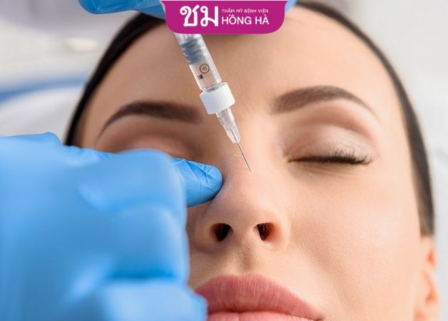 Quy trình tiêm filler nâng mũi được thực hiện theo 4 bước cơ bản