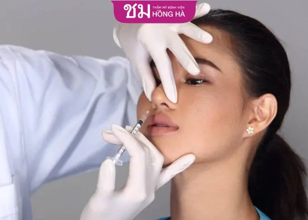 Thời gian tiêm filler nâng mũi ổn định nhanh, kết quả duy trì trong khoảng 12 - 18 tháng