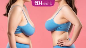 Làm sao để vòng 1 không bị chảy xệ? Bật mí bí quyết siêu đỉnh